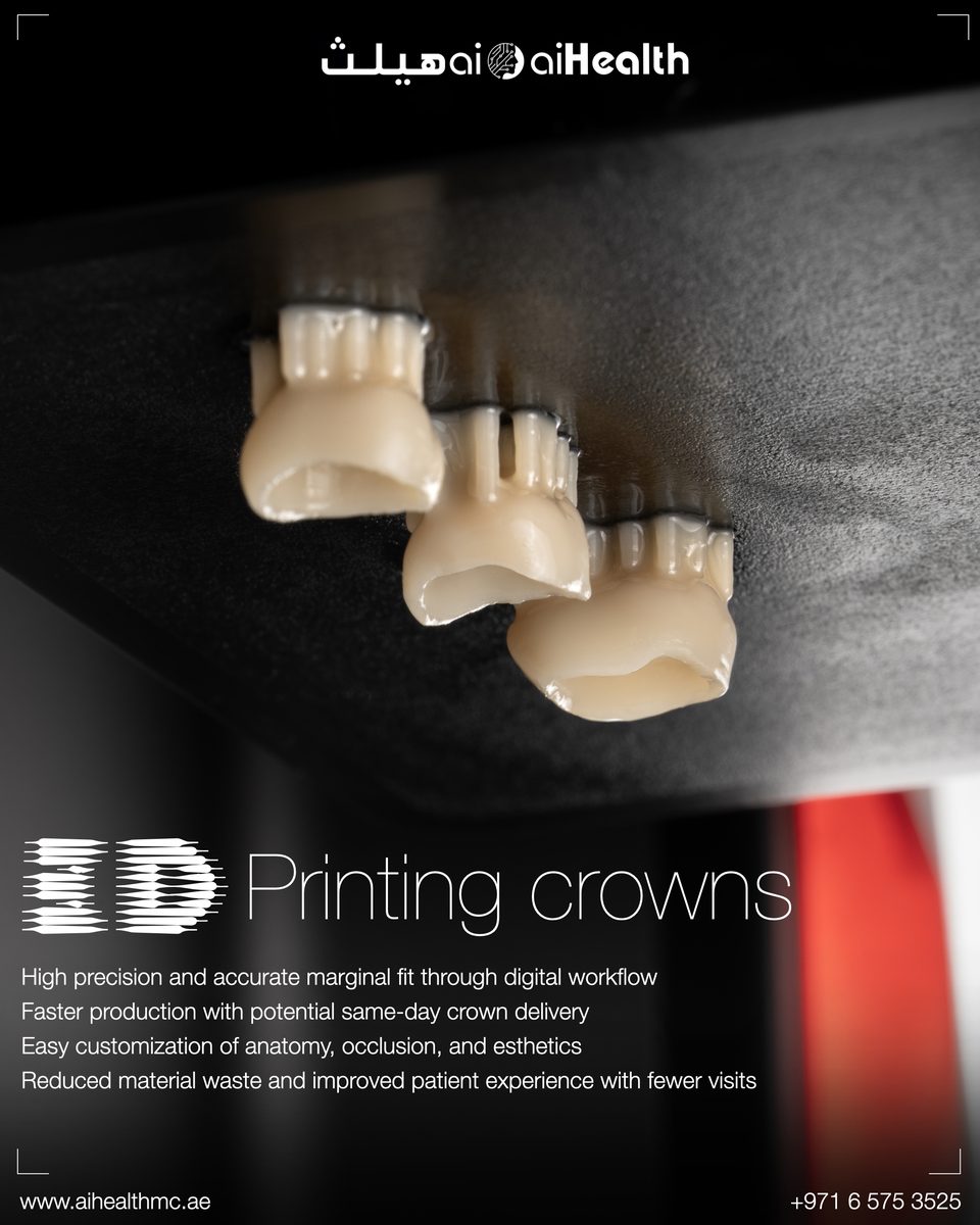 3D-Printed Crowns